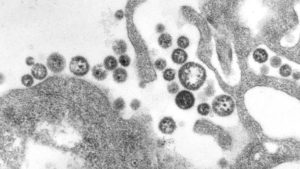 Virion contenant des virus de Lassa en microscopie électronique